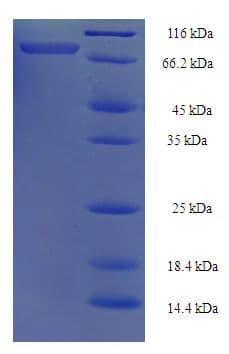 Human TRAF5 Protein (Recombinant His-SUMO)