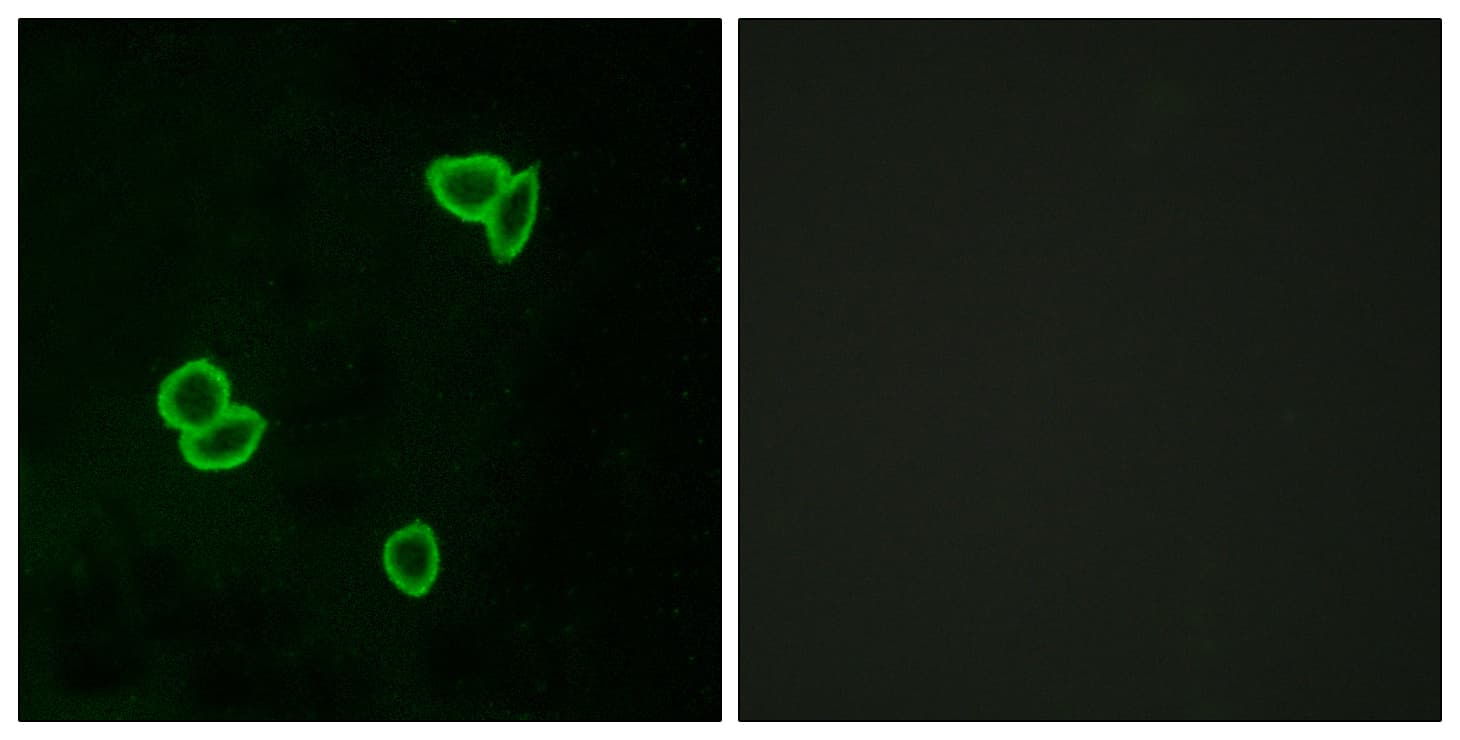 ADGRL1 / LPHN1 Antibody (aa561-610)