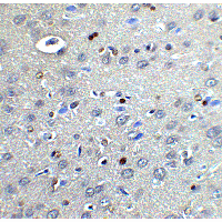 CYBB / NOX2 / gp91phox Antibody
