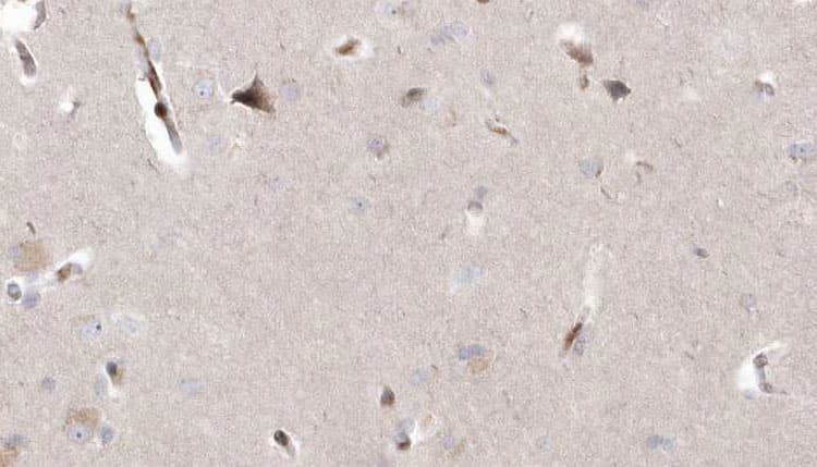 Polyclonal Rabbit anti-Human MAGT1 Antibody (IHC, WB)