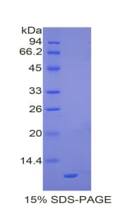 Mouse CCL20 / MIP-3-Alpha Protein (Recombinant His)