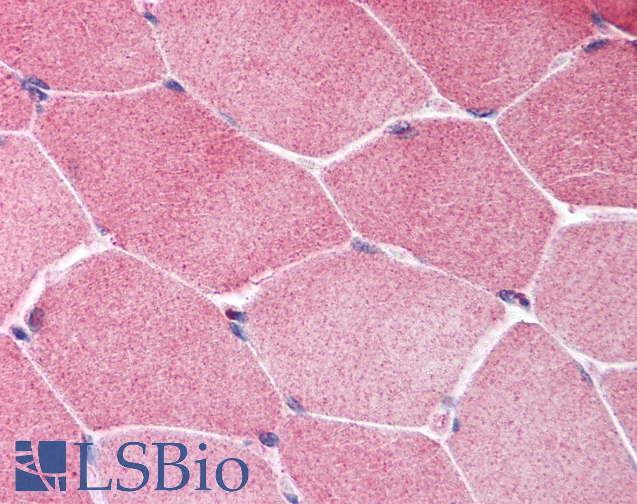 IHC-plus™ Hamartin / TSC1 Antibody