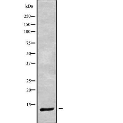 DYNLRB1 Antibody