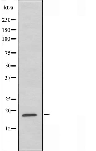 Polyclonal Rabbit anti-Human Sma3 Antibody (IF, WB)