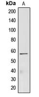 CREB3L2 / BBF2H7 Antibody (Internal)