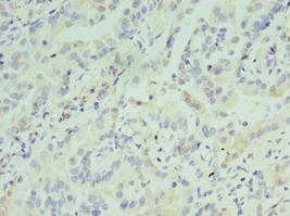 ATF7 Antibody (aa1-117)