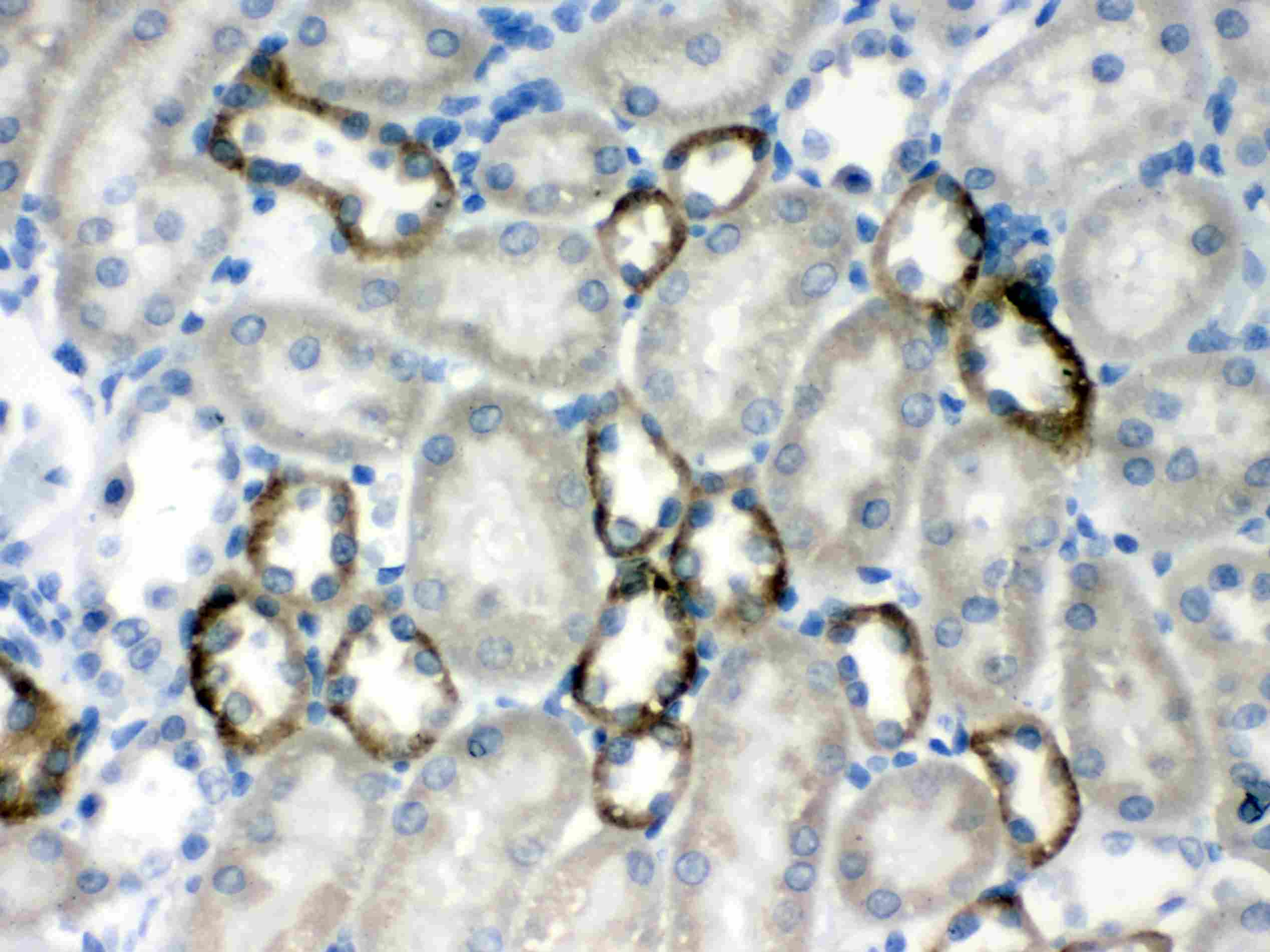 Polyclonal Rabbit anti-Human CASR/Calcium Sensing Receptor Antibody (IHC, WB)