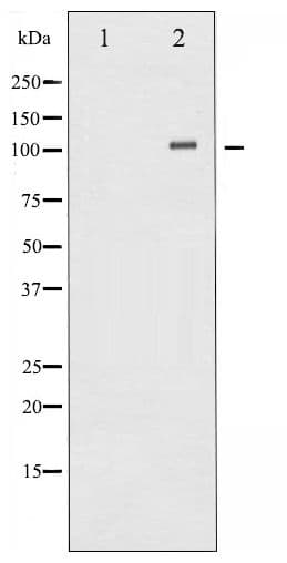 Polyclonal Rabbit anti-Human GRIA1 / GLUR1 Antibody (phospho-Ser863, IHC, WB)