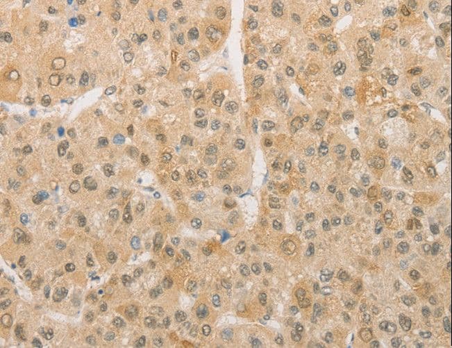PGK2 Antibody