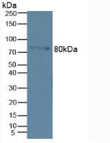 MMP9 / Gelatinase B Antibody (aa213-399)