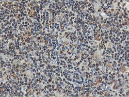 Monoclonal Mouse anti-Human FDFT1 / Squalene Synthase Antibody (clone OTI2F10, IHC, IF, WB)