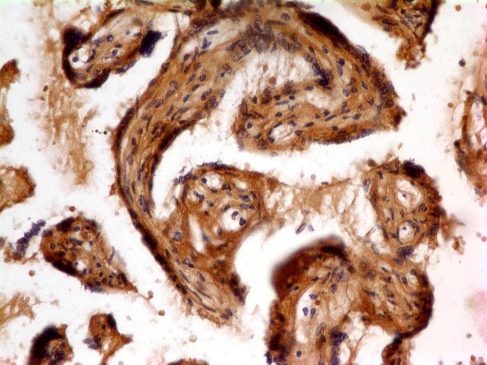 FLT1 / VEGFR1 Antibody