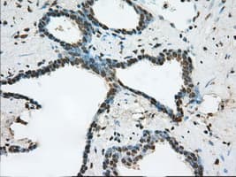 ERCC1 Antibody (clone OTI1B3)