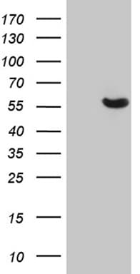 GC / Vitamin D-Binding Protein Antibody (clone OTI3H10)