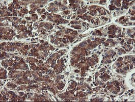 Monoclonal Mouse anti-Human VBP1 Antibody (clone OTI2C2, IHC, WB)