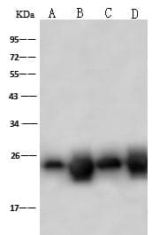 PSMB8 / LMP7 Antibody (Preservative Free)
