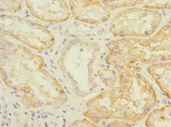 Polyclonal Rabbit anti-Human SLC22A8 / OAT3 Antibody (IHC)