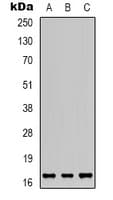 Angiogenin / ANG Antibody (N-Terminus)