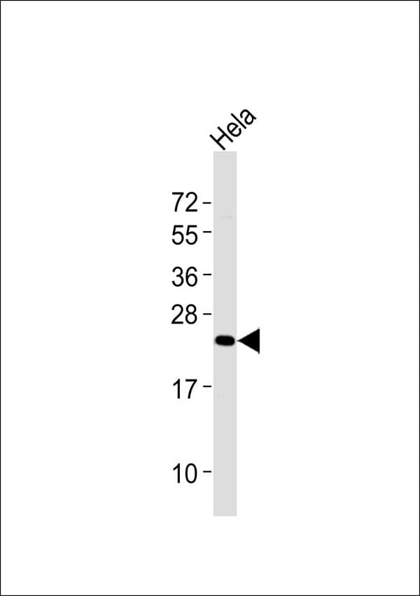 CYGB / Cytoglobin Antibody