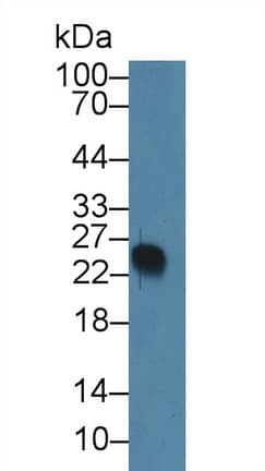 VPREB1 / CD179A Antibody (aa33-135, PE)