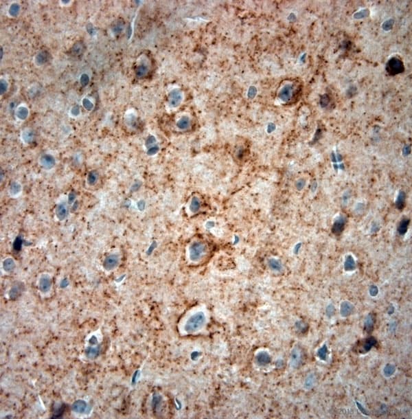 GAD 65+67 Antibody (aa530-600)
