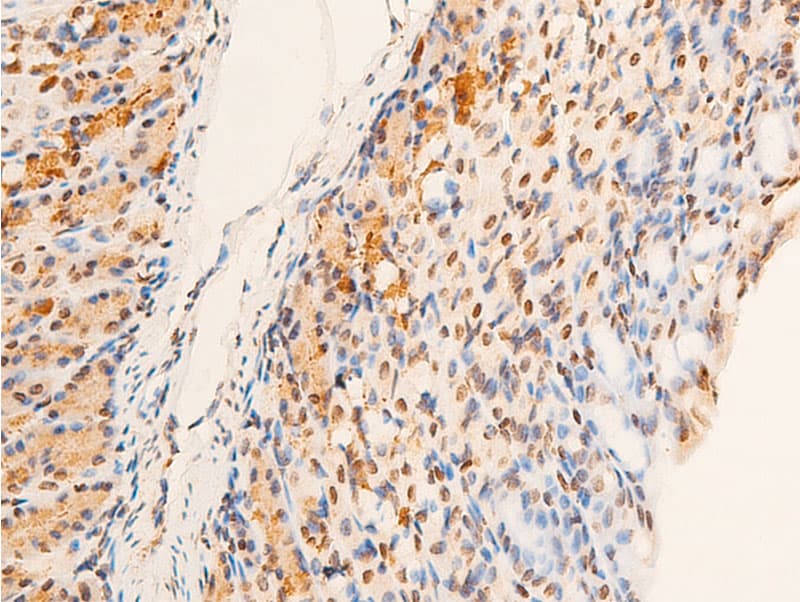 Polyclonal Rabbit anti-Human CHEK2 / CHK2 Antibody (phospho-Thr383, IHC, IF, WB)