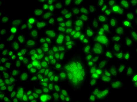 Polyclonal Rabbit anti-Human PPAN Antibody (IHC, IF, WB)
