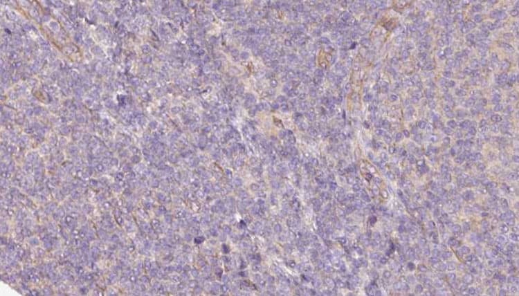 SPTLC2 / LCB2 Antibody