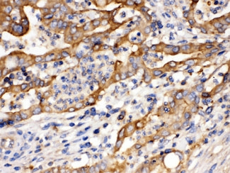 ACTN4 Antibody