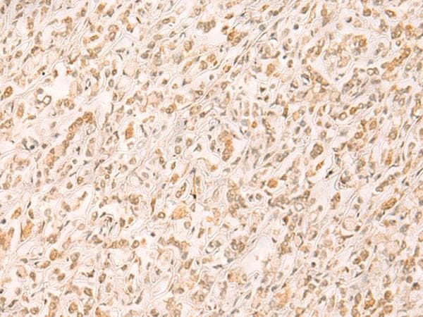 SETD1A / SET1 Antibody