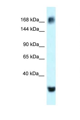 ATAD2 Antibody (aa1205-1254)