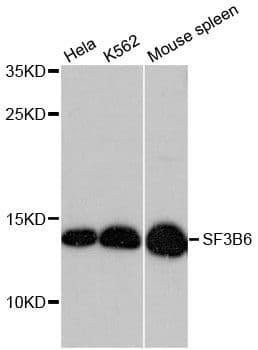 SF3B6 / SF3B14 Antibody