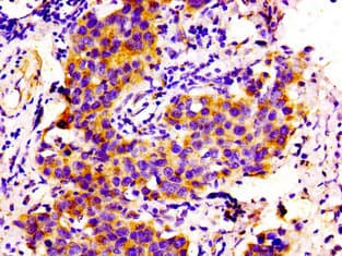 COL6A2 / Collagen VI Alpha 2 Antibody