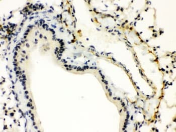 Polyclonal Rabbit anti-Human XBP1 Antibody (aa55-89, IHC, WB)