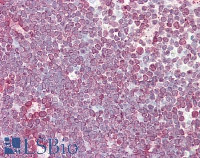 Polyclonal Rabbit anti-Human TMPO / TP / Thymopoietin Antibody (aa1-243, IHC, WB)