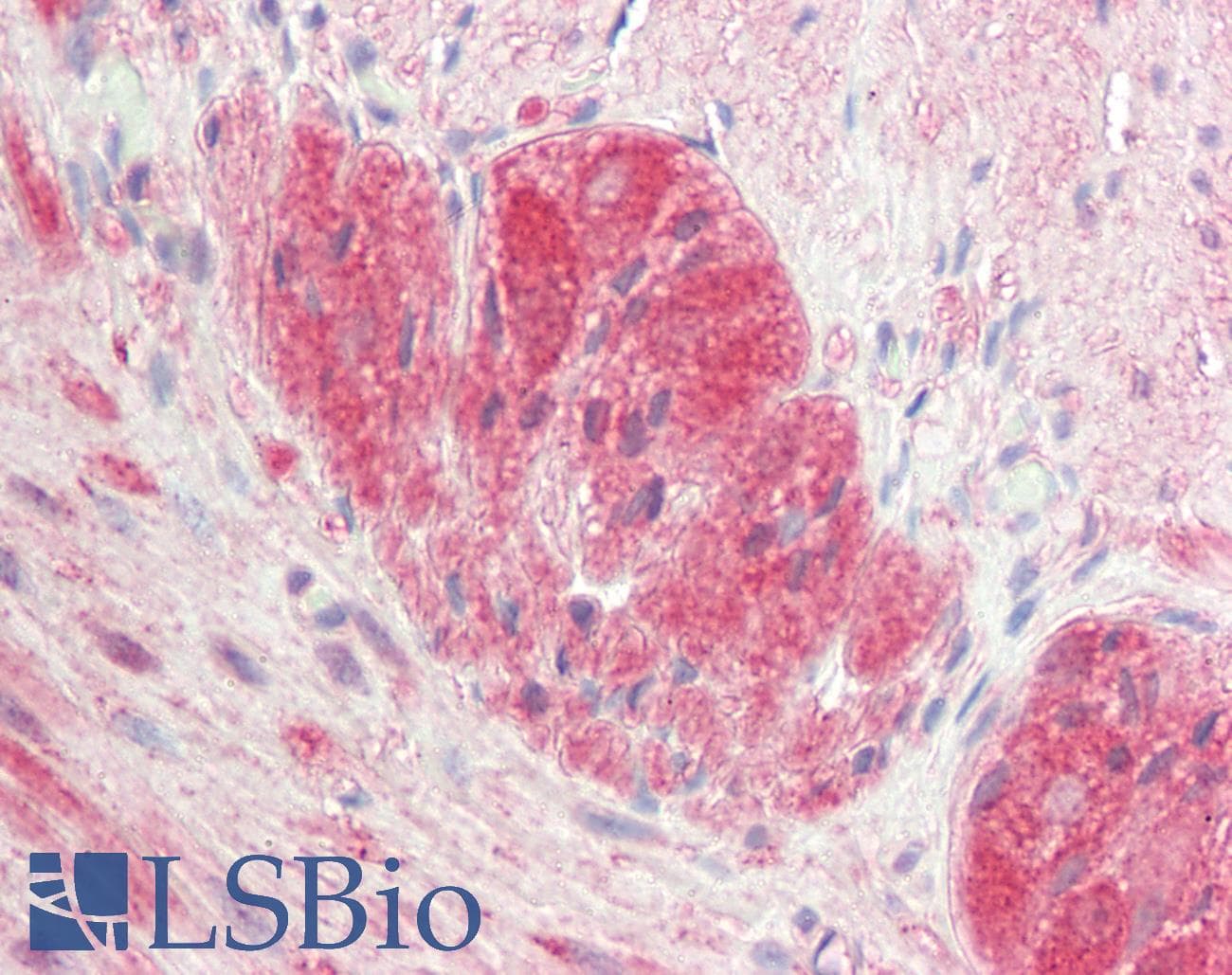 PathPlus™ Monoclonal Mouse anti-Human RET Antibody (clone 1A5, IHC, WB)