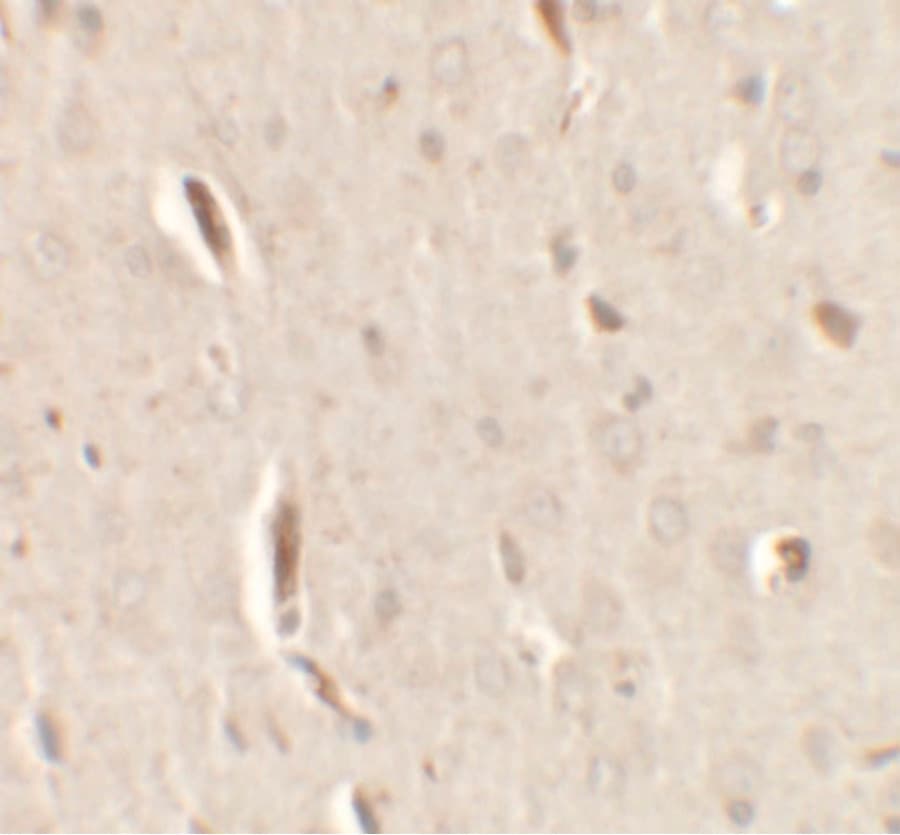 Polyclonal Rabbit anti-Human GRIP1 Antibody (IHC, IF, WB)