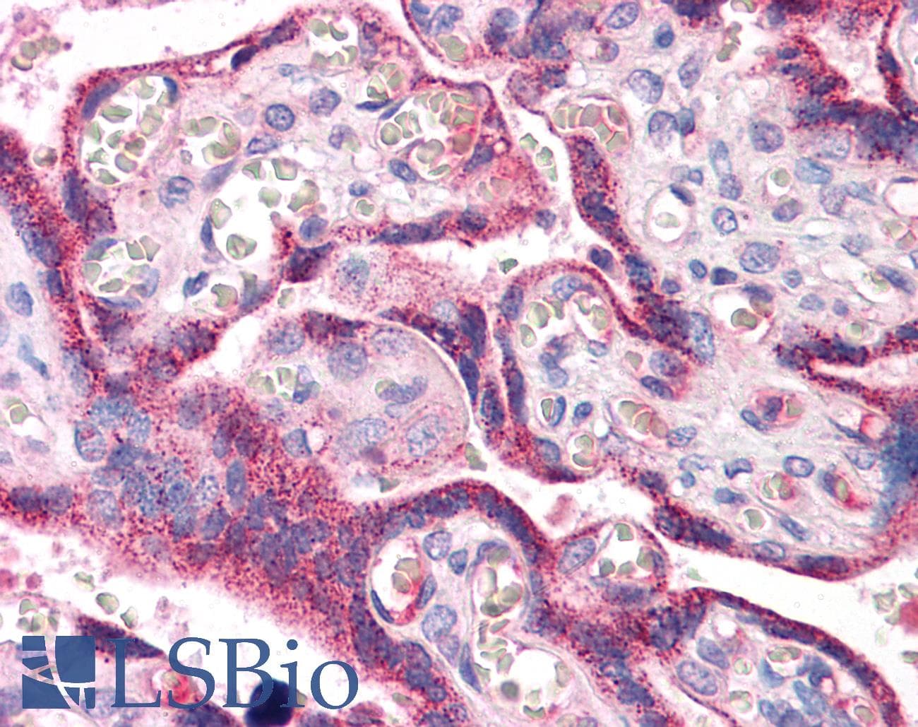 Polyclonal Rabbit anti-Human RYBP Antibody (aa71-120, IHC, WB)