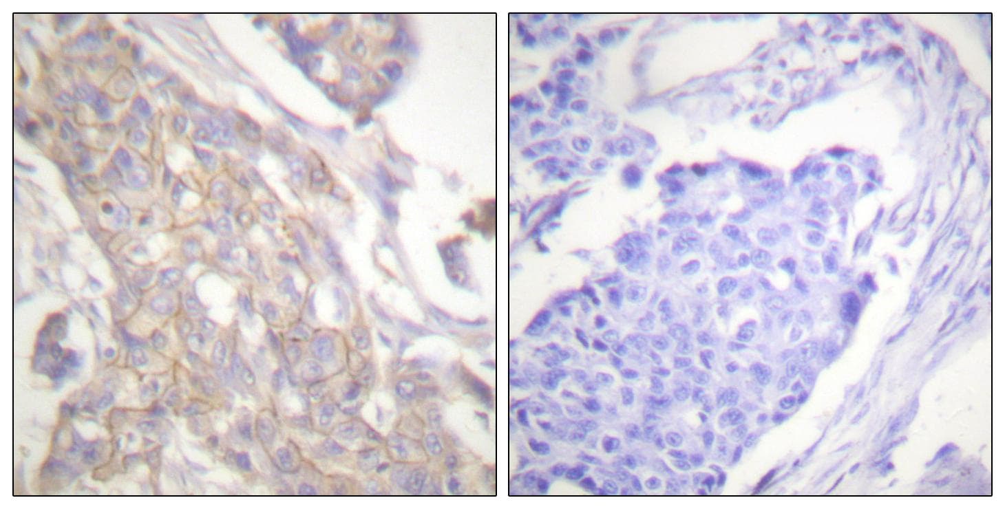 Polyclonal Rabbit anti-Human c-Src Kinase / CSK Antibody (p364, IHC, WB)