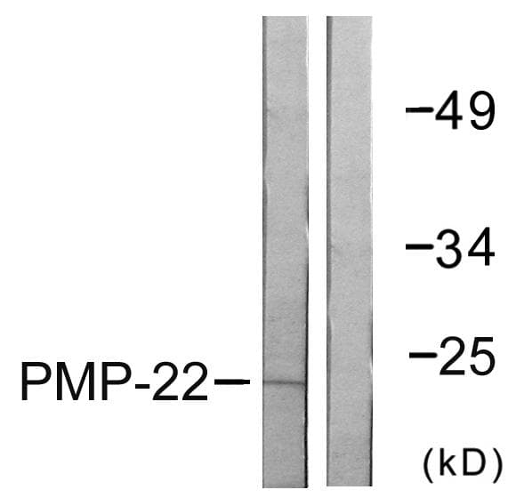 PMP22 Antibody