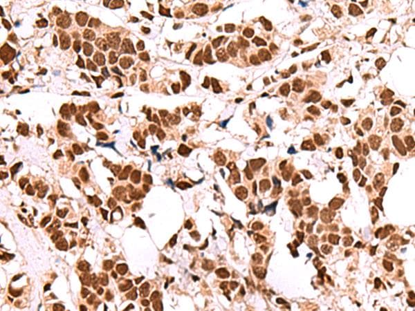 FOXK2 / ILF Antibody