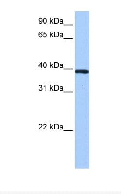 ZNF618 Antibody (aa111-160)