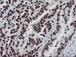 Monoclonal Mouse anti-Human MEIS3 Antibody (clone OTI3C9, IHC, WB)