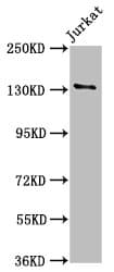 NPHS1 / Nephrin Antibody (aa23-257)
