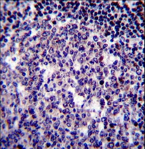 Polyclonal Rabbit anti-Human BIRC3 / cIAP2 Antibody (aa59-88, IHC, IF, WB)