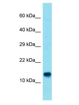 ATP11AUN Antibody (aa70-119)