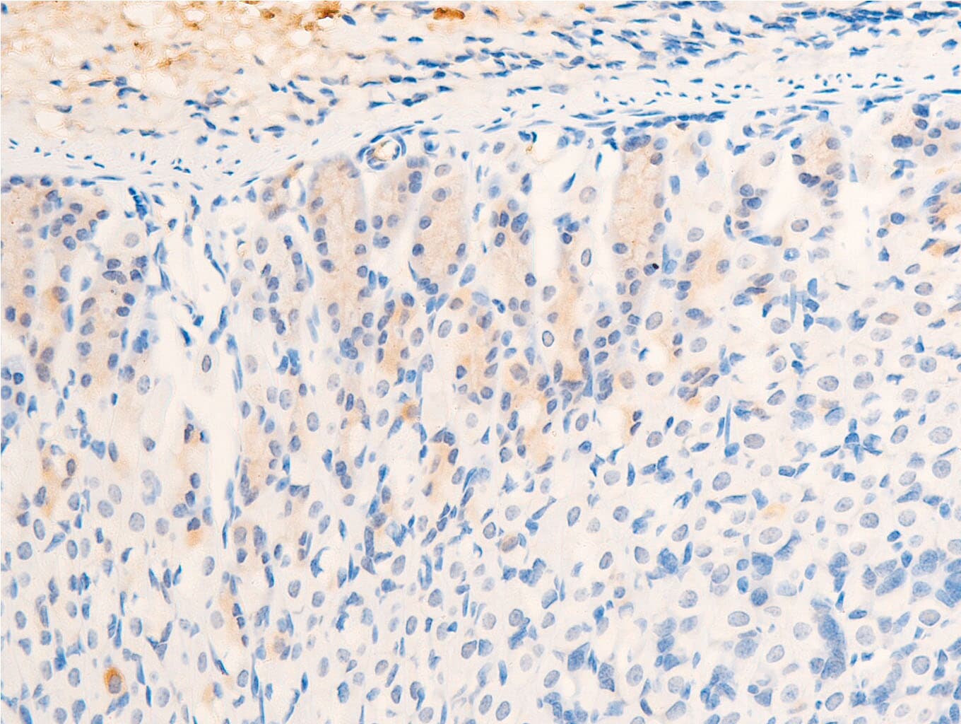 EGFR Antibody (phospho-Ser1026)