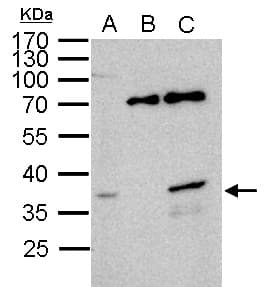 WBSCR22 Antibody (aa1-263)
