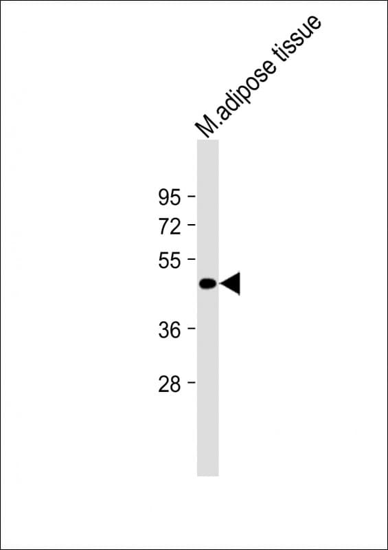 Polyclonal Rabbit anti-Human TNMD / Tenomodulin Antibody (IHC, WB)