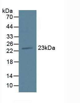 TMEM27 / Collectrin Antibody (aa12-222, APC)